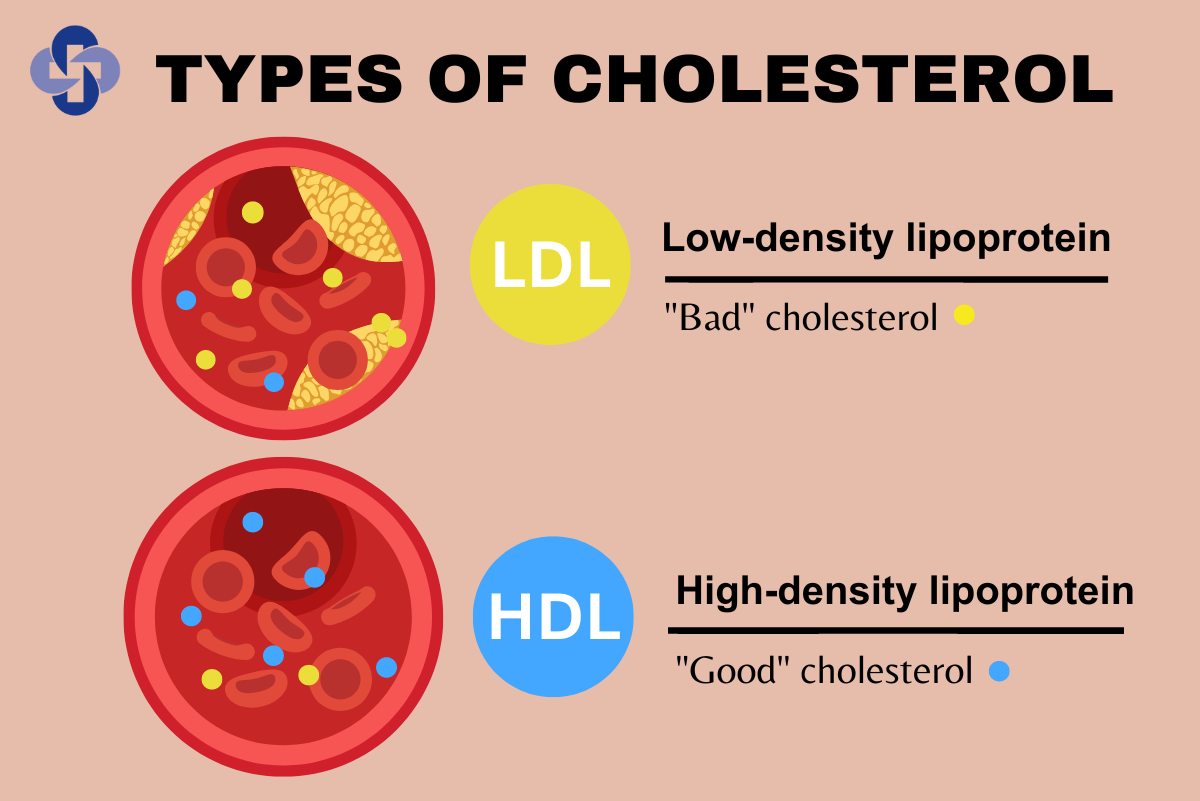 Cholesterol: The Good and the Bad | St. Mary's Health Care System
