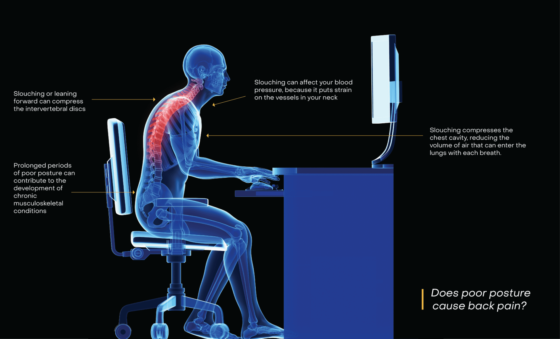 Spine Health: Posture and Workplace Ergonomics | National Spine Health Foundation