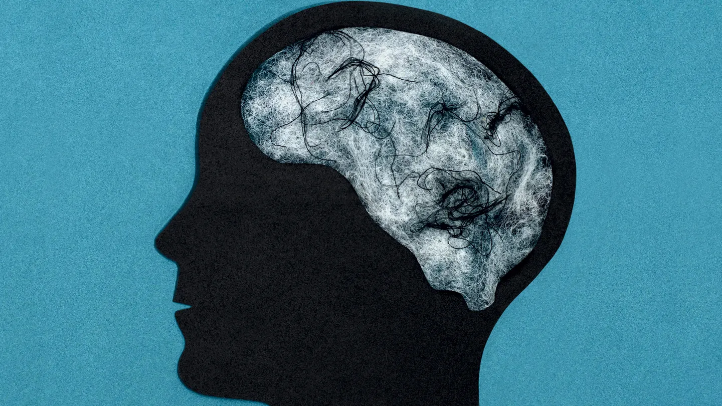 Brain Fog: Causes, Impacts and Strategies to Improve Mental Clarity -  Starling Minds