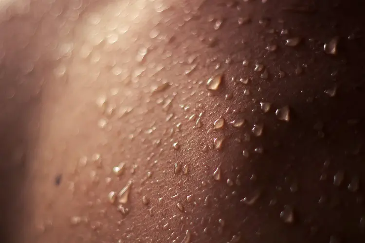 Causes of Excessive Sweating: Primary and Secondary Hyperhidrosis