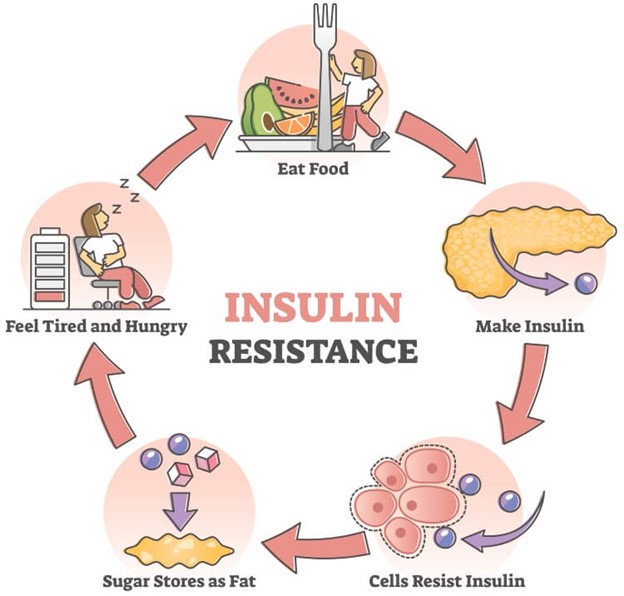 How to Tell If You're Insulin-Resistant: Essential Guide